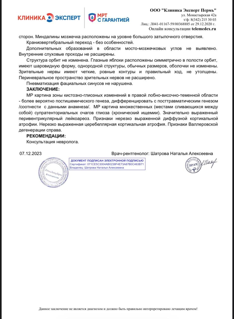 МРТ головного мозга, заключение