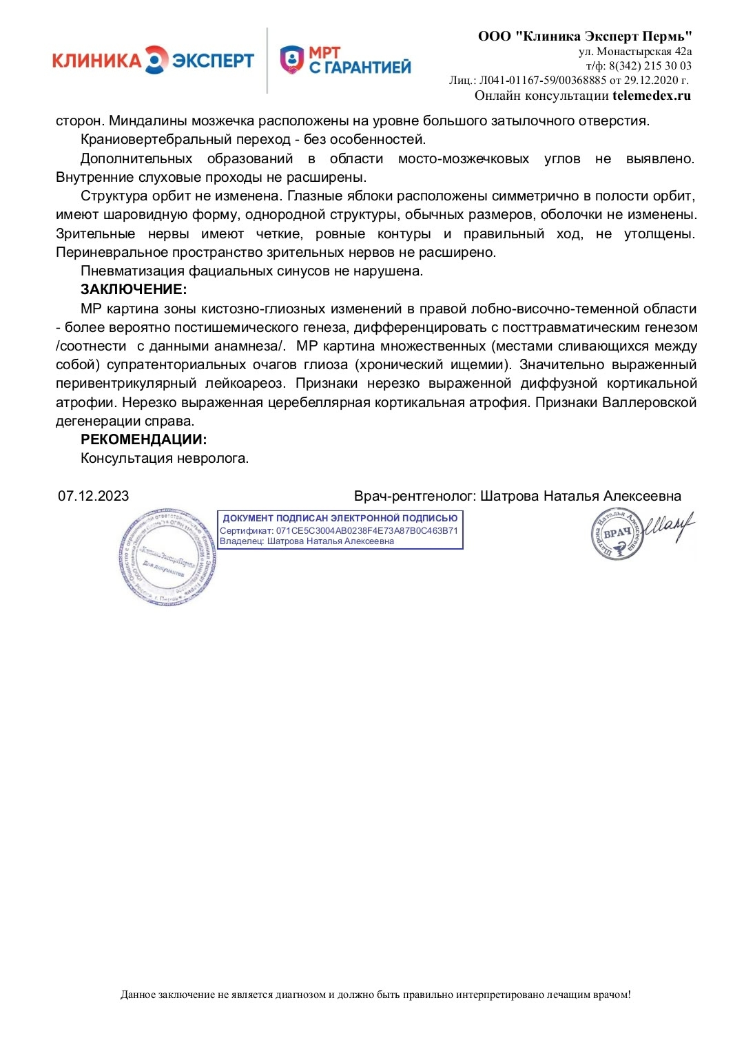 МРТ головного мозга, заключение